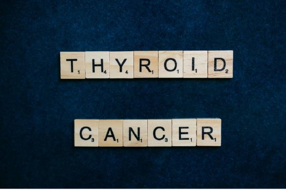 Visible Symptoms of Thyroid Cancer